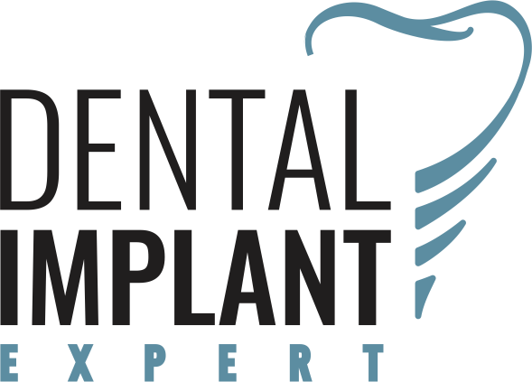 Dental Implant Expert